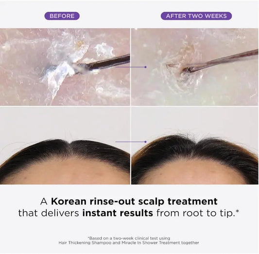 Dr. Groot Hair Loss Treatment Miracle in Shower, UK - URZ TRADE