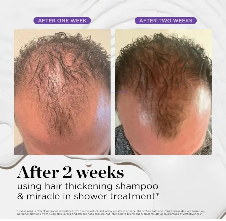 Dr. Groot Hair Loss Treatment Miracle in Shower, UK - URZ TRADE