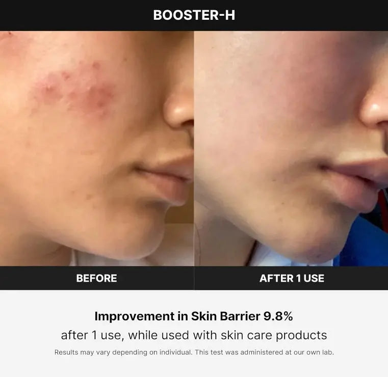 Medicube Age-R Booster H Skin Device - 100% Original & UK Medicube Age-R Booster H - Korean No.1 Skin Care Device Medicube