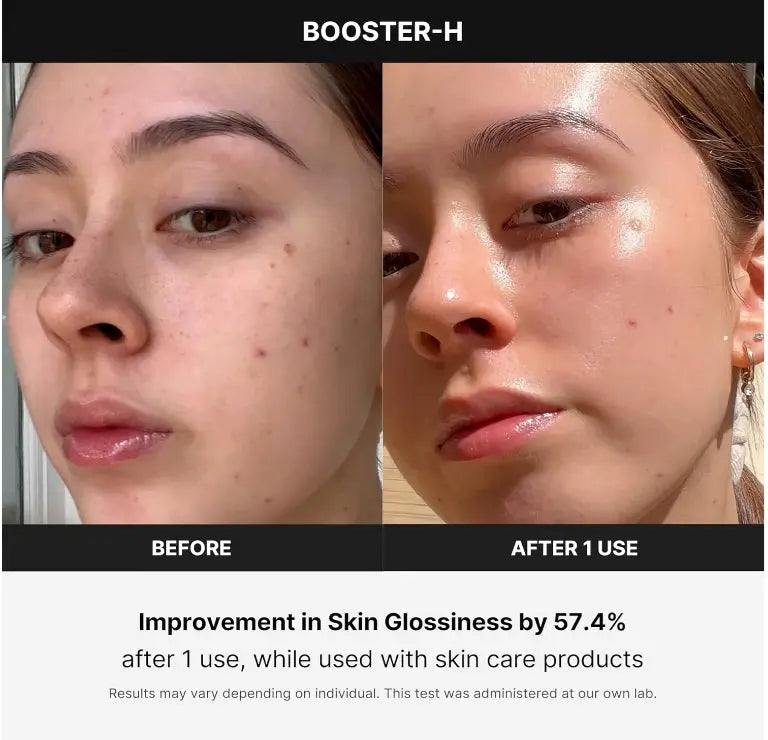 Medicube Age-R Booster H Skin Device - 100% Original & UK Medicube Age-R Booster H - Korean No.1 Skin Care Device Medicube