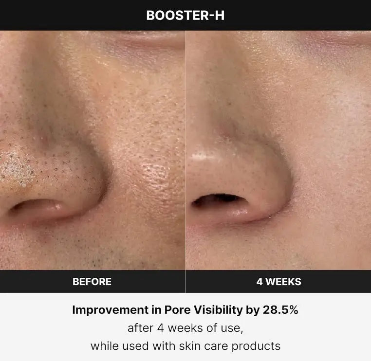 Medicube Age-R Booster H Skin Device - 100% Original & UK Medicube Age-R Booster H - Korean No.1 Skin Care Device Medicube