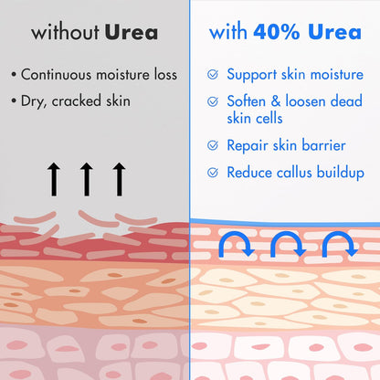 Comparison of skin conditions with and without 40% Urea, showing benefits on a gray and blue background.